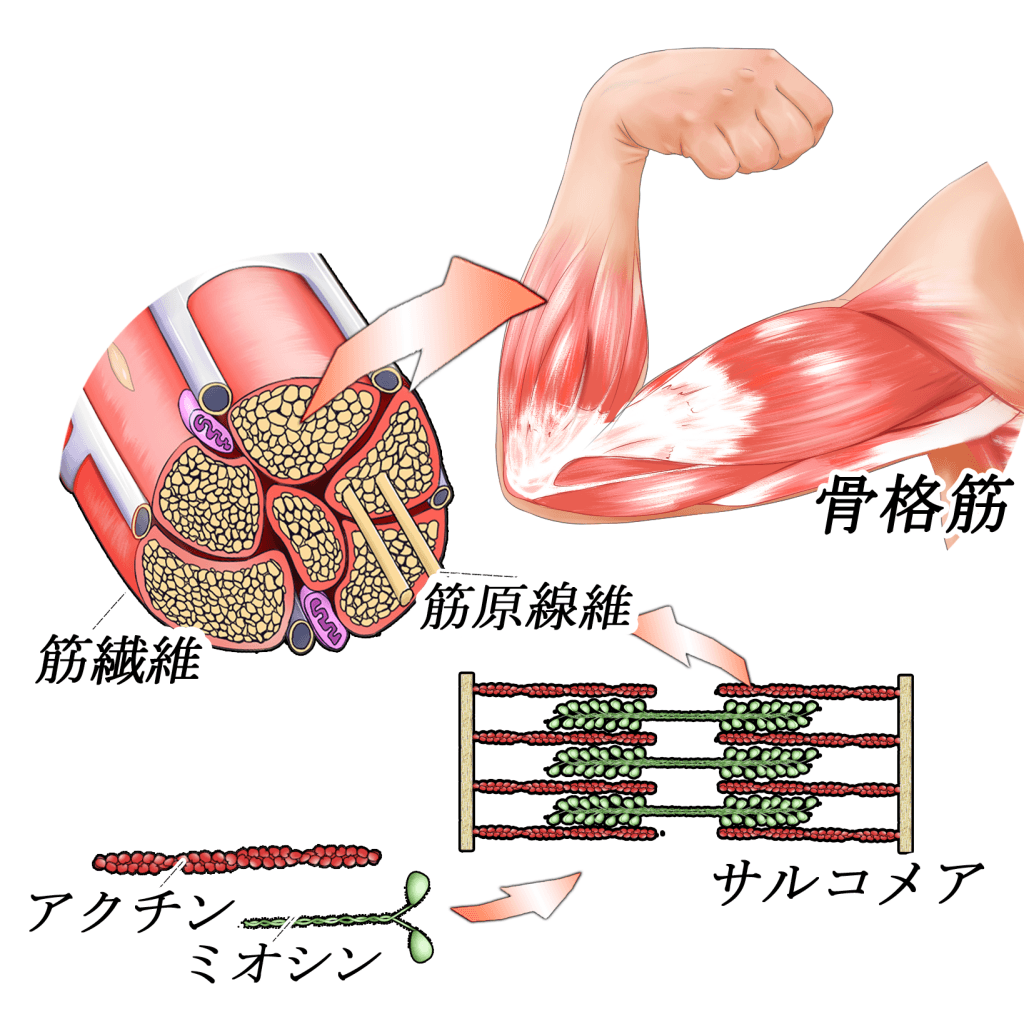 筋 を 違える