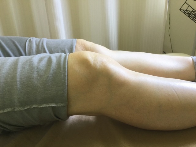 膝関節症には、運動療法や薬物療法などの保存療法と、人工膝関節置換術などの手術療法があります。症状に応じた適切な治療法を選び、膝の健康を保ちましょう。