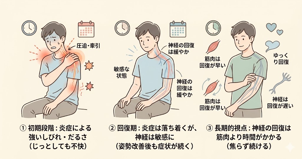 胸郭出口症候群の症状変化