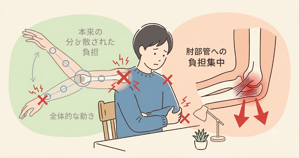 肘部管症候群が治りにくい理由のイラスト図